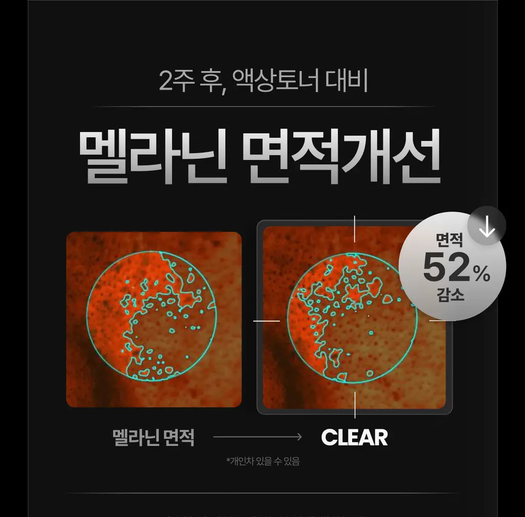[미백/잡티케어] 가쉬 타겟티드 브라이트닝 겔 미스트 100ml 상세페이지 36